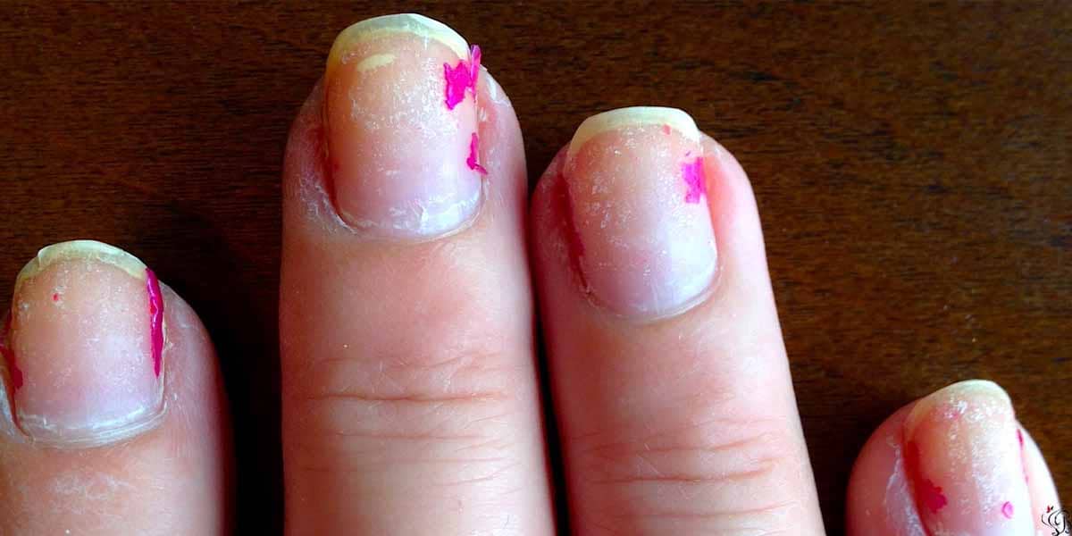 how to remove gel nail polish