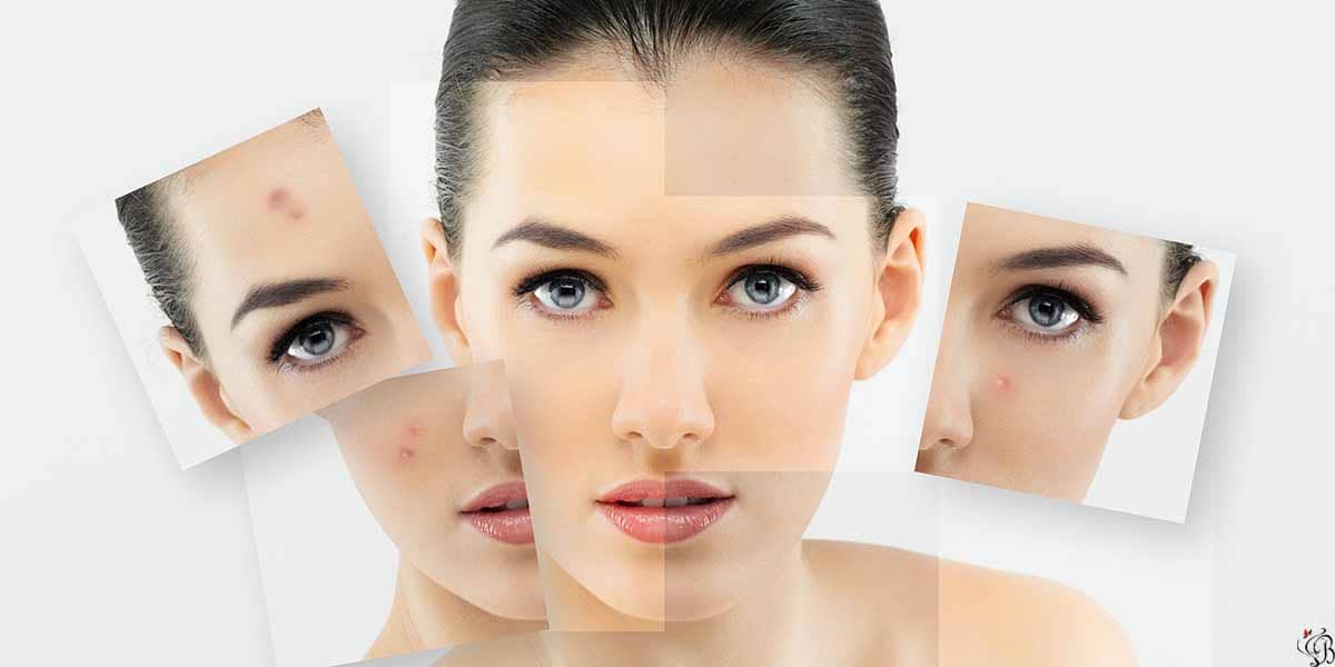 best skin lightening cream for hyperpigmentation
