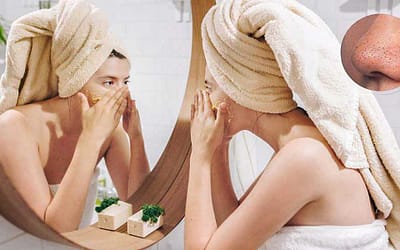 how to get rid of blackheads