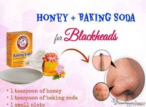 baking soda and honey for blackheads