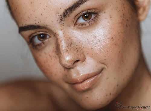 best skin lightening cream for hyperpigmentation for black skin